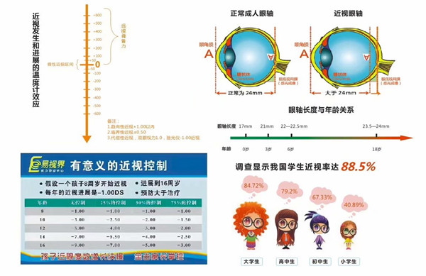 视力下降的原因有哪些【易视界】