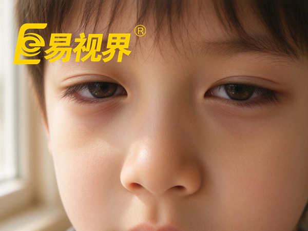 减少青少年眼干涩的食物有哪些 易视界视光中心